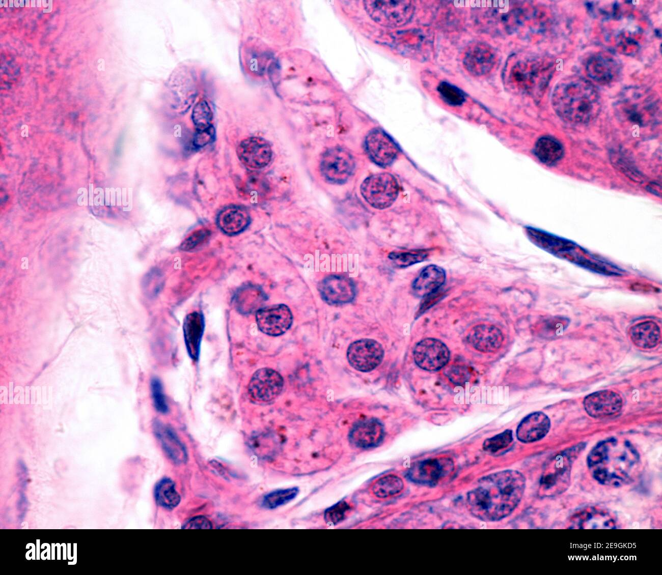 Mikrograph mit hoher Vergrößerung einer Gruppe interstitieller Leydig-Zellen im Hoden. Sie sind polyedrische Zellen des eosinophilen Zytoplasmas, die Pi zeigen Stockfoto