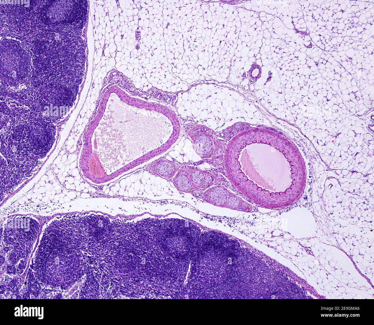 Muskelarterie, Vene und Nervenbündel umgeben von Fettgewebe, in der Nähe eines Lymphknotens. Die Arterie (rechts) hat eine dickere Wand und einen kleineren Durchmesser Stockfoto