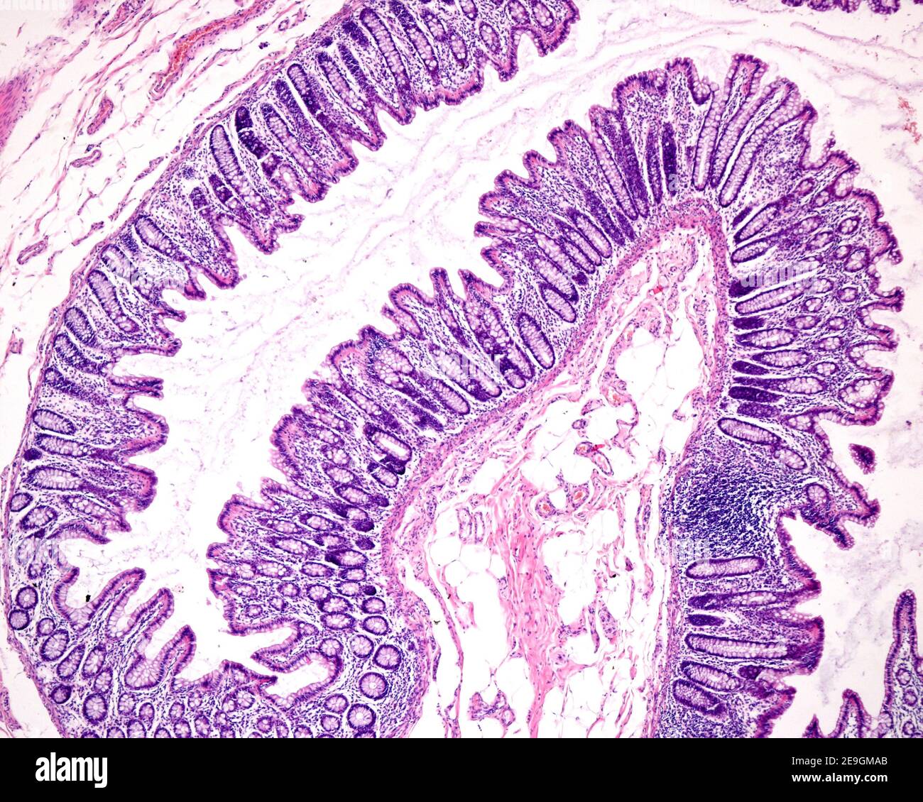 Schleimhaut des Dickdarms mit Lieberkühn-Krypten, ausgekleidet mit zahlreichen Kelchzellen des blassen Zytoplasmas. Die rosafarbene Schicht darunter ist die Muscularis Stockfoto