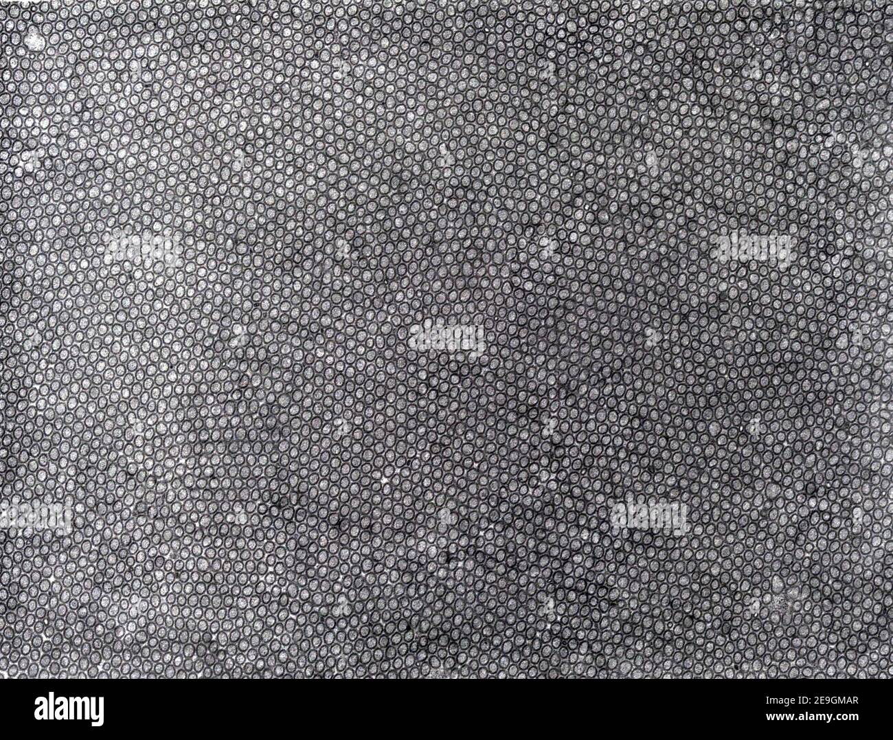 Transmissionselektronenmikroskop (TEM)-Mikrograph mit einem Pinsel (oder gestreift) im Querschnitt. Die Mikrovilli dieser Dünndarmzelle A Stockfoto