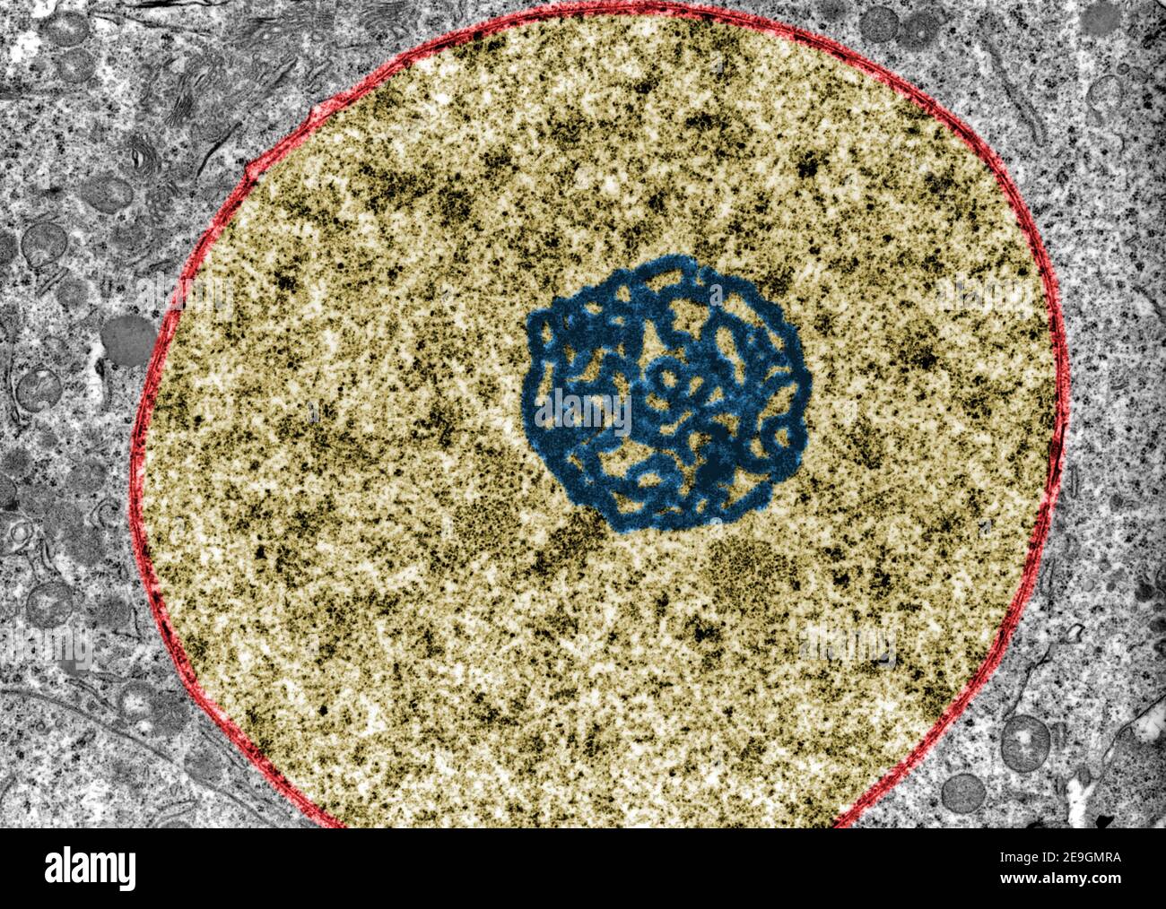 Mikrograph des falschen Farbtransmissionselektronenmikroskops (TEM), der die Ultrastruktur zeigt Eines Kerns (Gold) mit einem sehr ausgeprägten Nucleolus (blau) A Stockfoto