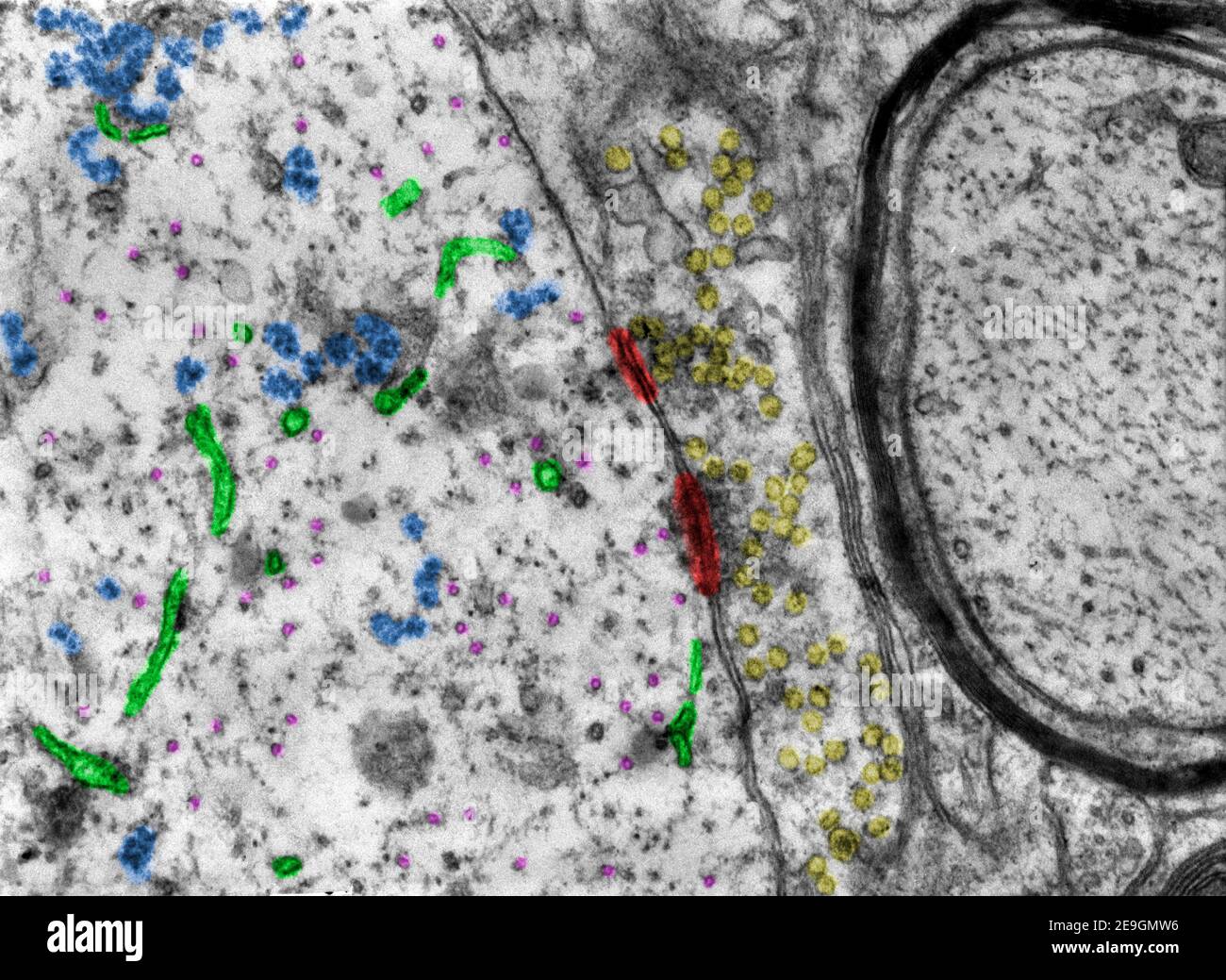 Mikrograph mit Falschfarben-Transmissionselektronenmikroskop (TEM), der zwei Synapsen zeigt. Synaptische Dichten=rot. Synaptische Vesikel=gelb. Ribosomen=blau. Stockfoto