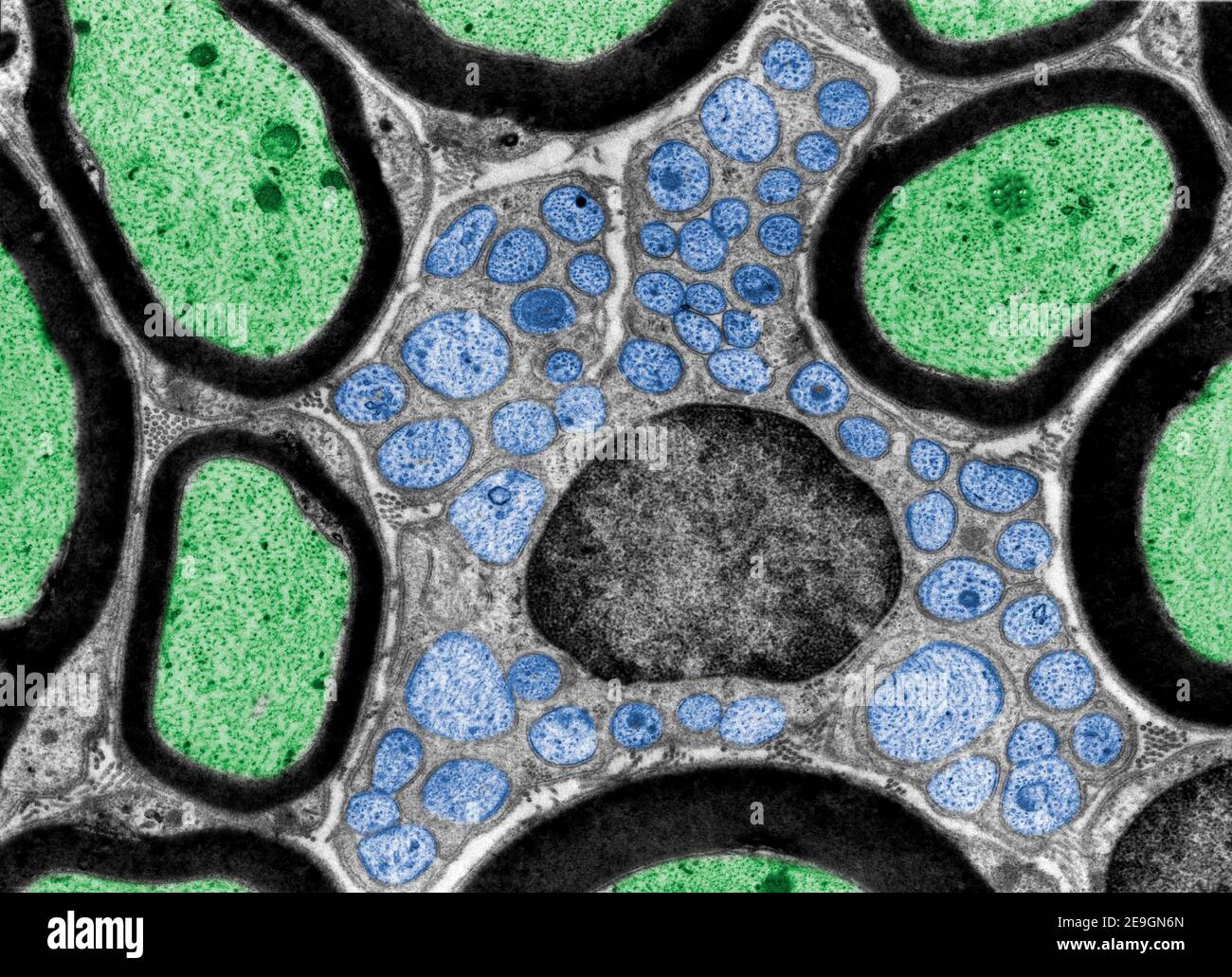 Mikrograph mit Falschfarben-Transmissionselektronenmikroskop (TEM), der mehrere myelinierte Mikroskope zeigt Fasern (grün) und eine Schwann-Zelle (in der Mitte) enthaltend Stockfoto