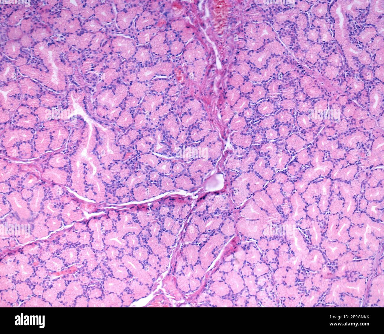 Brunner Drüsen des Duodenums mit ihrem typischen Aussehen von tubuloazinären Schleimdrüsen. Stockfoto