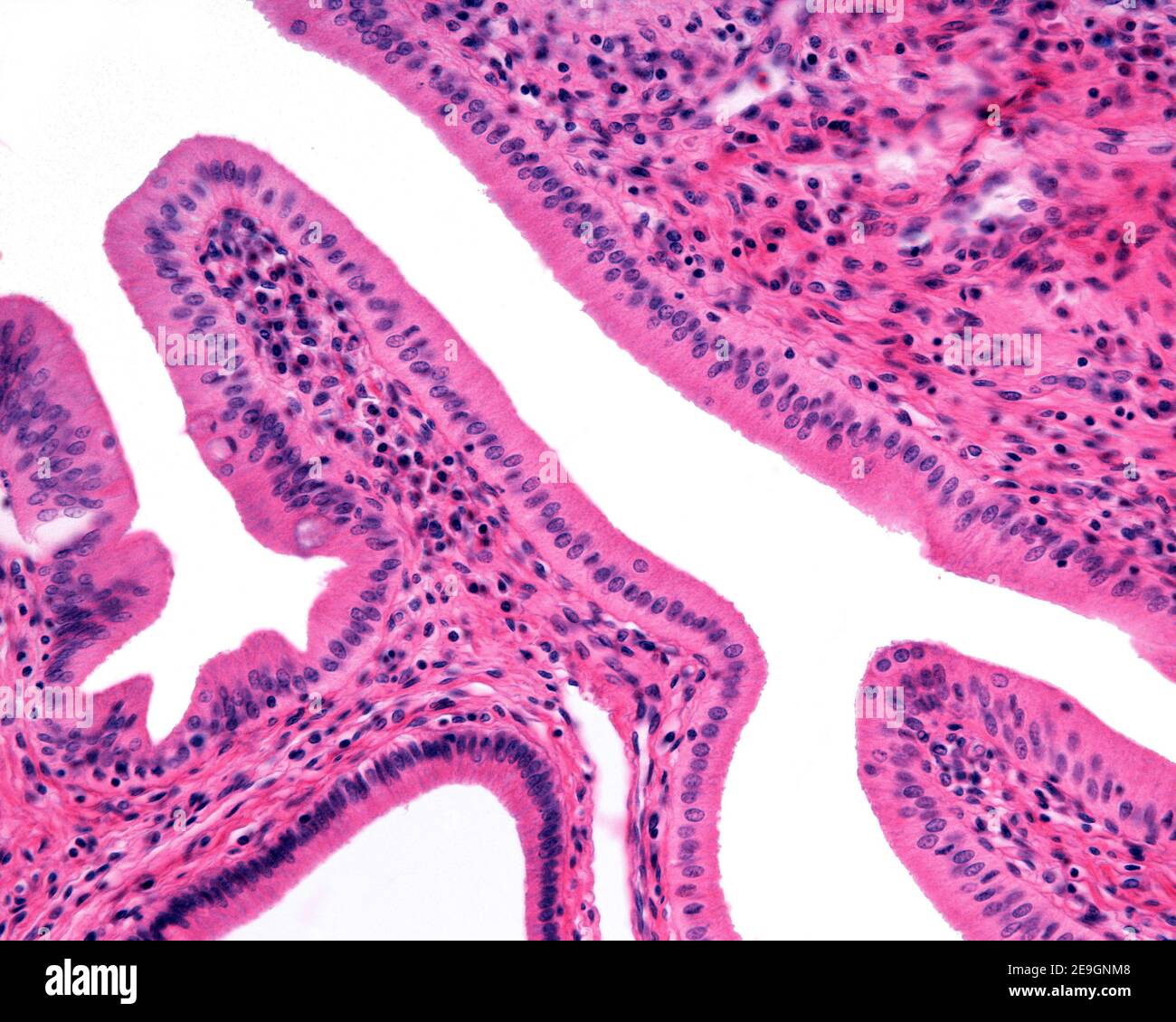 Mikrograph mit hoher Vergrößerung, der das einfache Säulenepithel zeigt, das den Gallengang am Ampulle von Vater auskleidet. Stockfoto