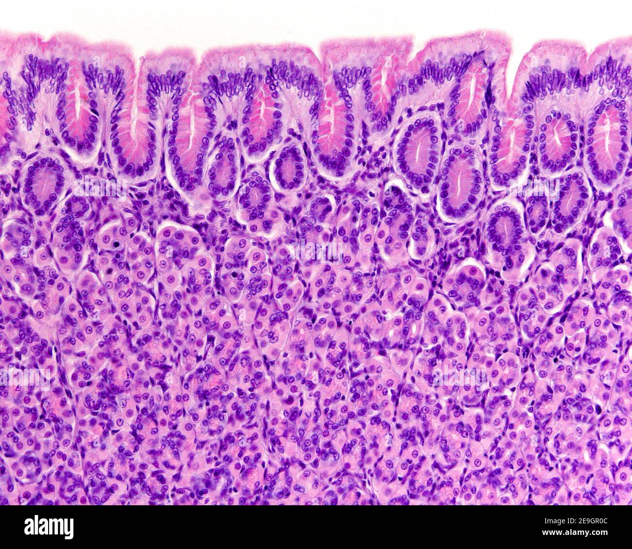 Magenschleimhaut, die das Schleimepithel der Oberfläche, die Magengruben und die Funddrüsen mit vielen rosa Parietalzellen zeigt Stockfoto