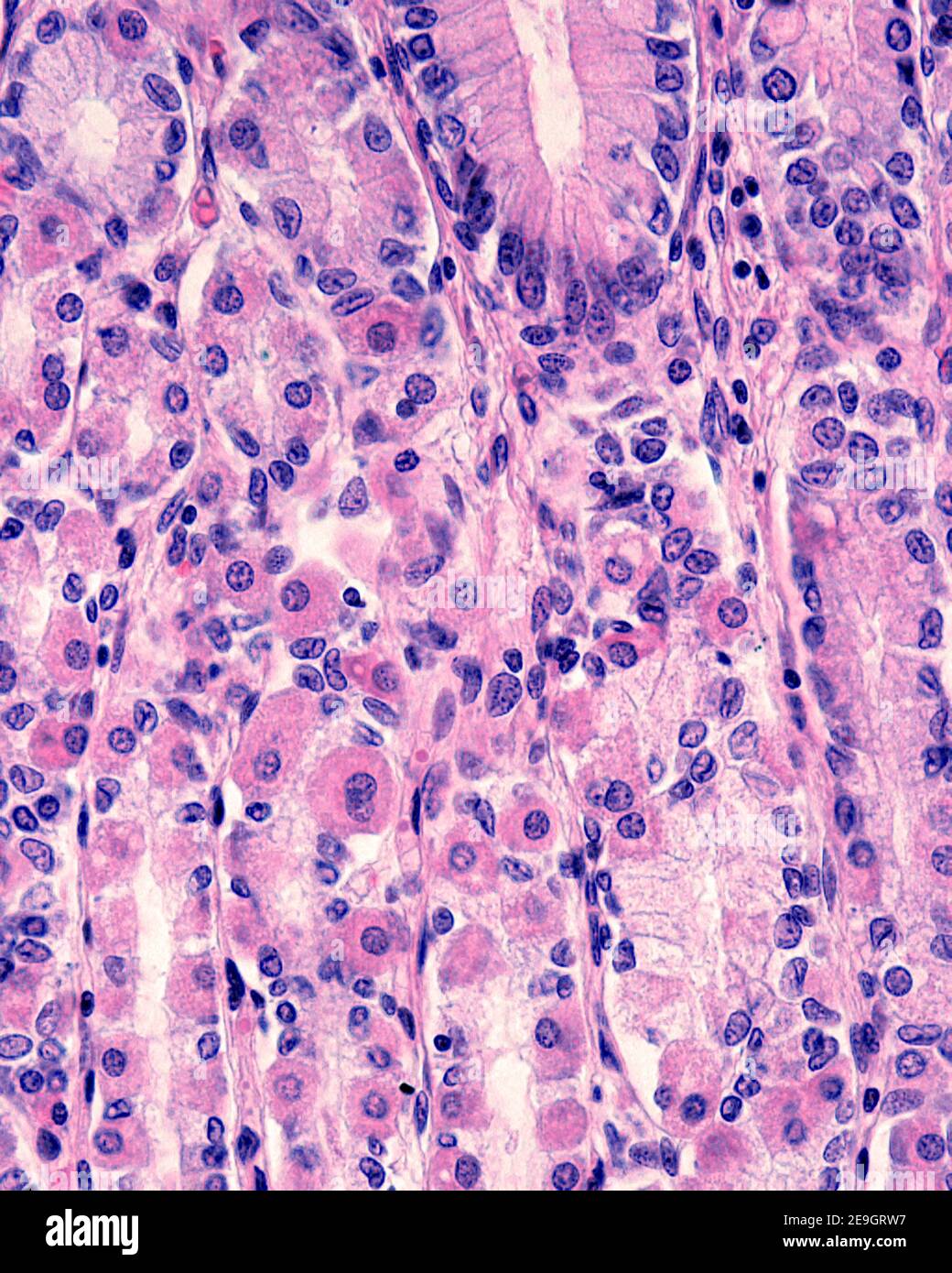 Parietale (oxyntische) Zellen sind ein Zelltyp, der sich in den fundischen Drüsen des Magens befindet. Sie haben ein eosinophiles (rosa) Zytoplasma. Stockfoto