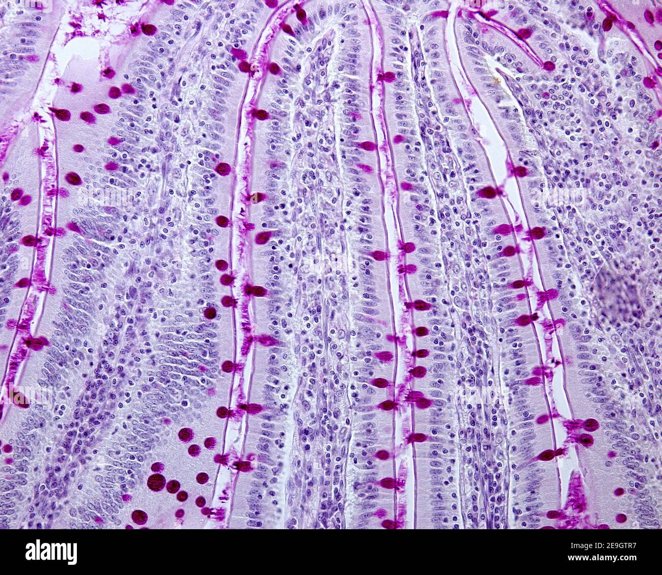 Hämatoxylin eosin färbung -Fotos und -Bildmaterial in hoher Auflösung –  Alamy