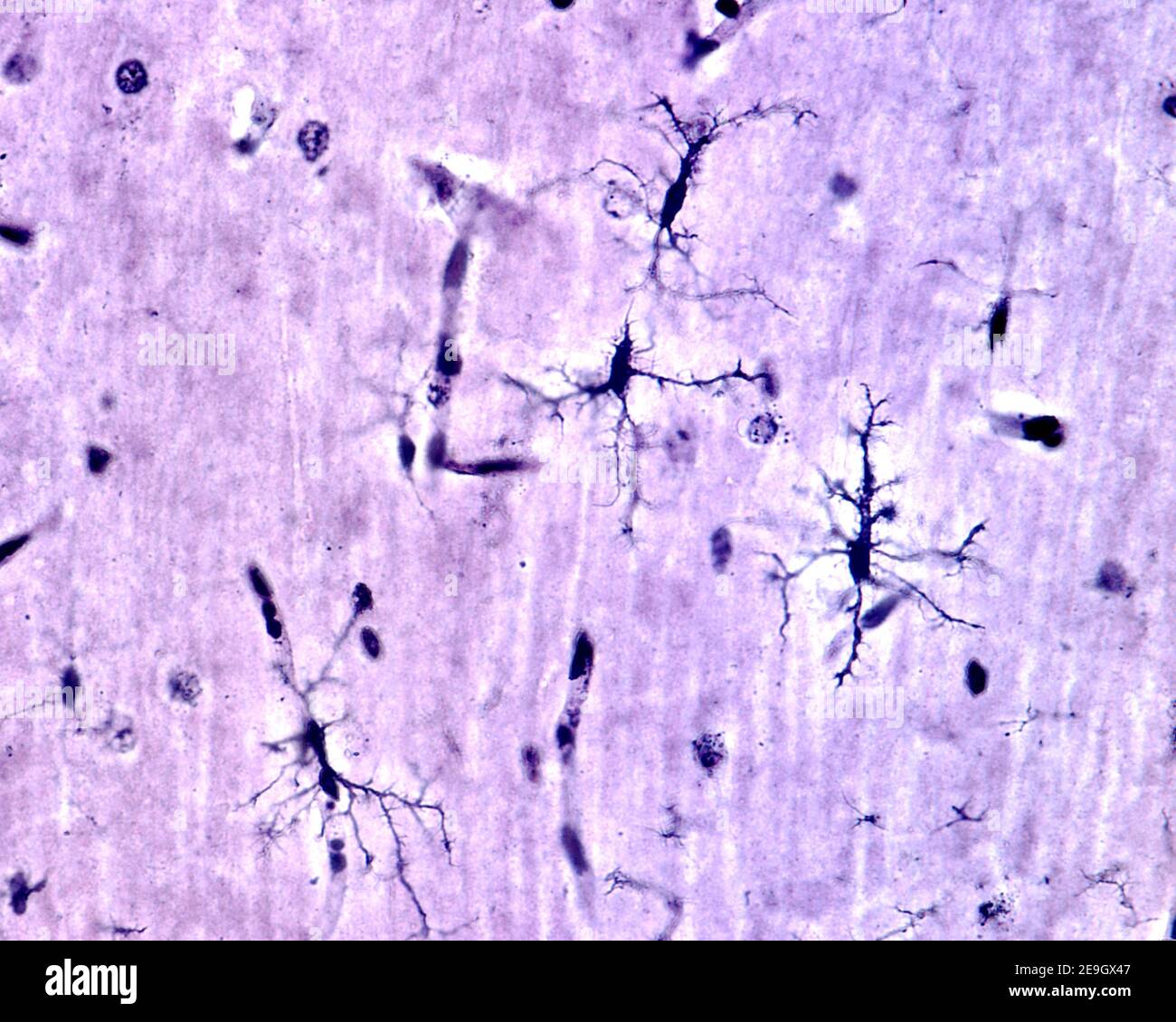 Mikroglia-Zellen, die mit der Silberkarbonat-Methode von Rio Hortega in der grauen Substanz des Gehirns gefärbt wurden. Dieser Typ ist die verzweigte oder 'resting' Mikroglia Stockfoto