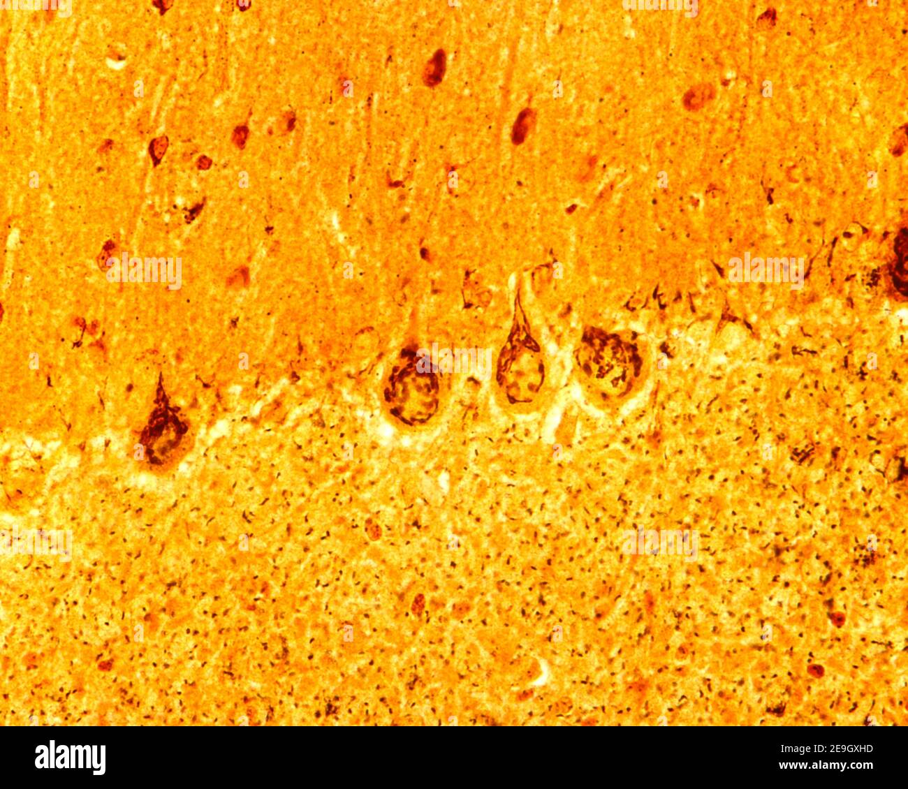 Kleinhirnrinde. Silber-Methode für Golgi-Apparat. In Purkinje Neuronen umgeben die Dictyosomen den Kern und gelangen in den apikalen dendritischen Stamm Stockfoto