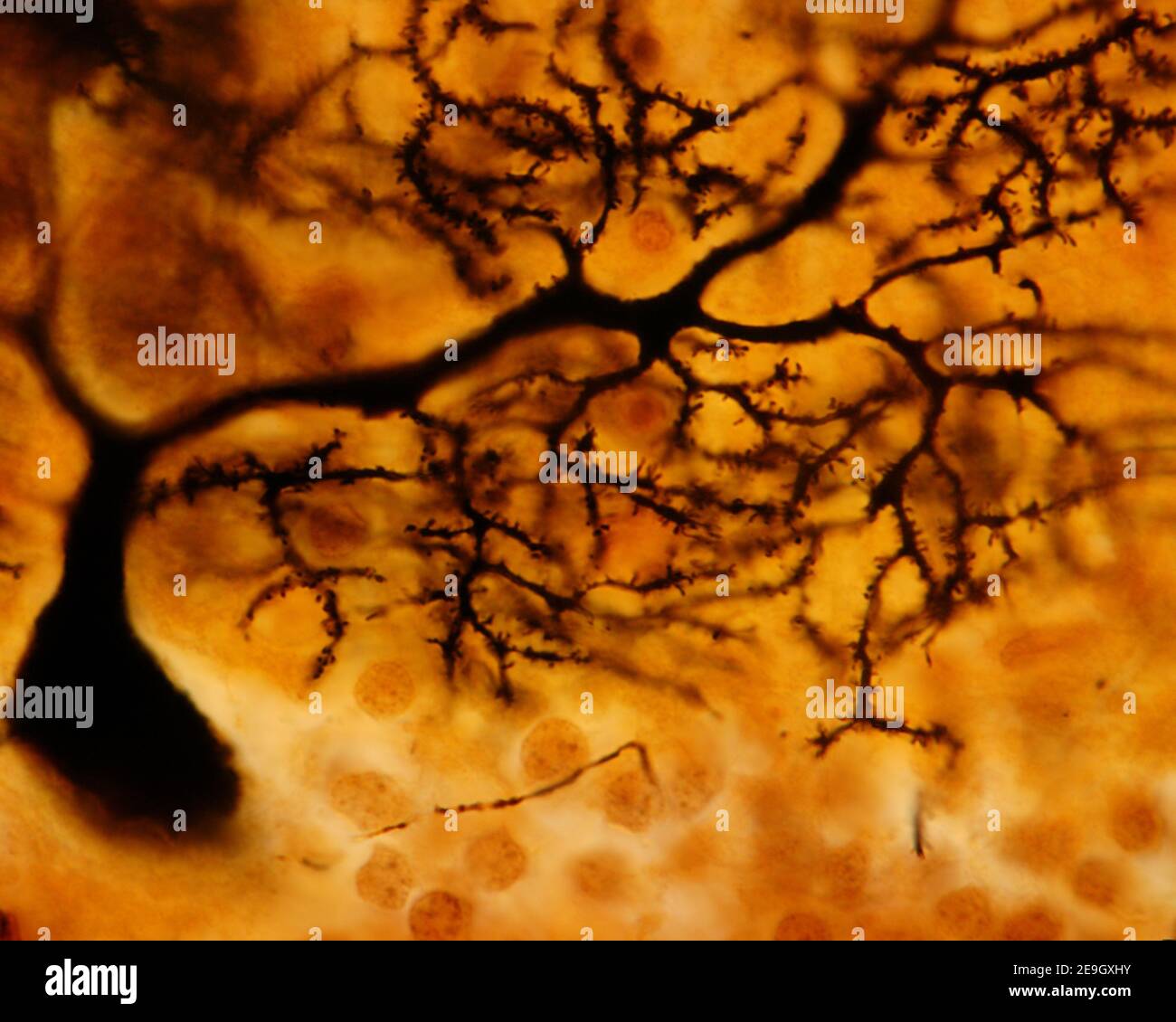 Purkinje Neuron des Kleinhirnrindes. Golgis Silberchromat zeigt Dendriten, die aus dem Soma stammen. Die dünnsten Zweige zeigen reichlich Stacheln Stockfoto