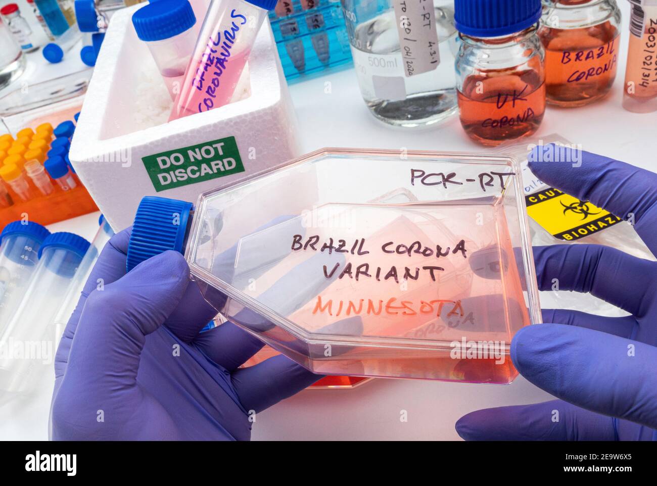 Wissenschaftler hält Ampulle von neuen brasilianischen covid-19 Stamm in Minnesota in der Forschung gefunden, Konzept Bild Stockfoto