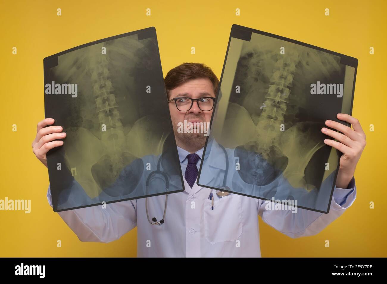 Männlich Arzt hält Röntgen-oder Roentgen-Bild wird mit Ergebnissen verwechselt. Studioaufnahme Stockfoto