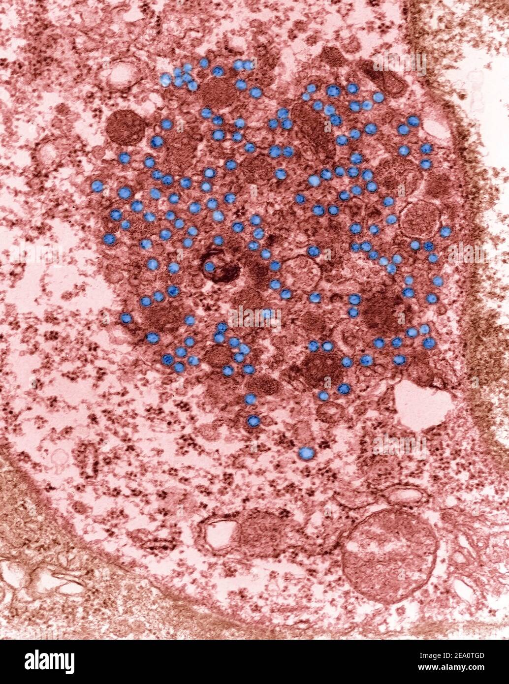Maus Mammatumor Virus, TEM Stockfoto