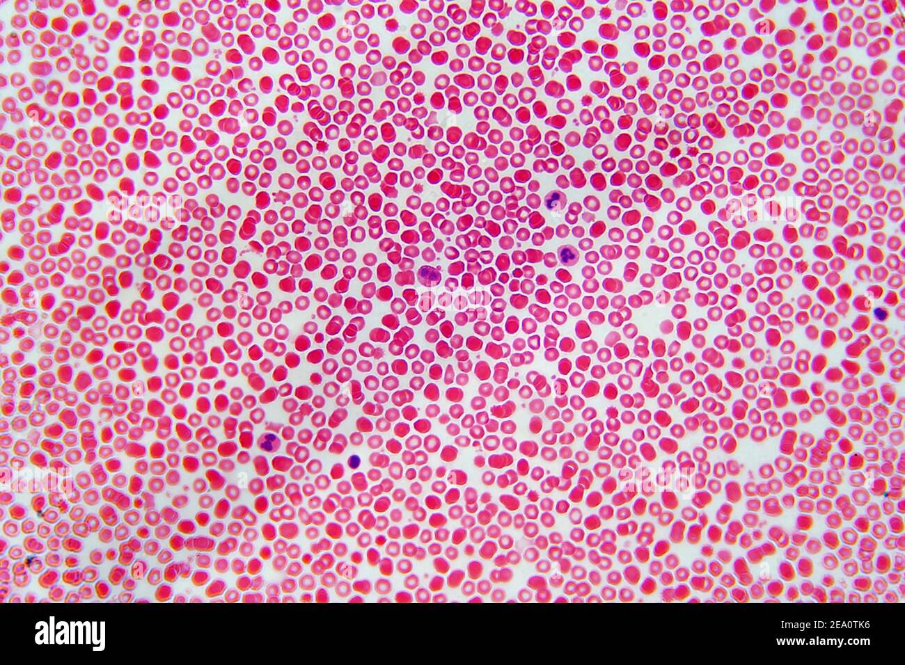 Blutzellen, leichte Mikrograph Stockfoto
