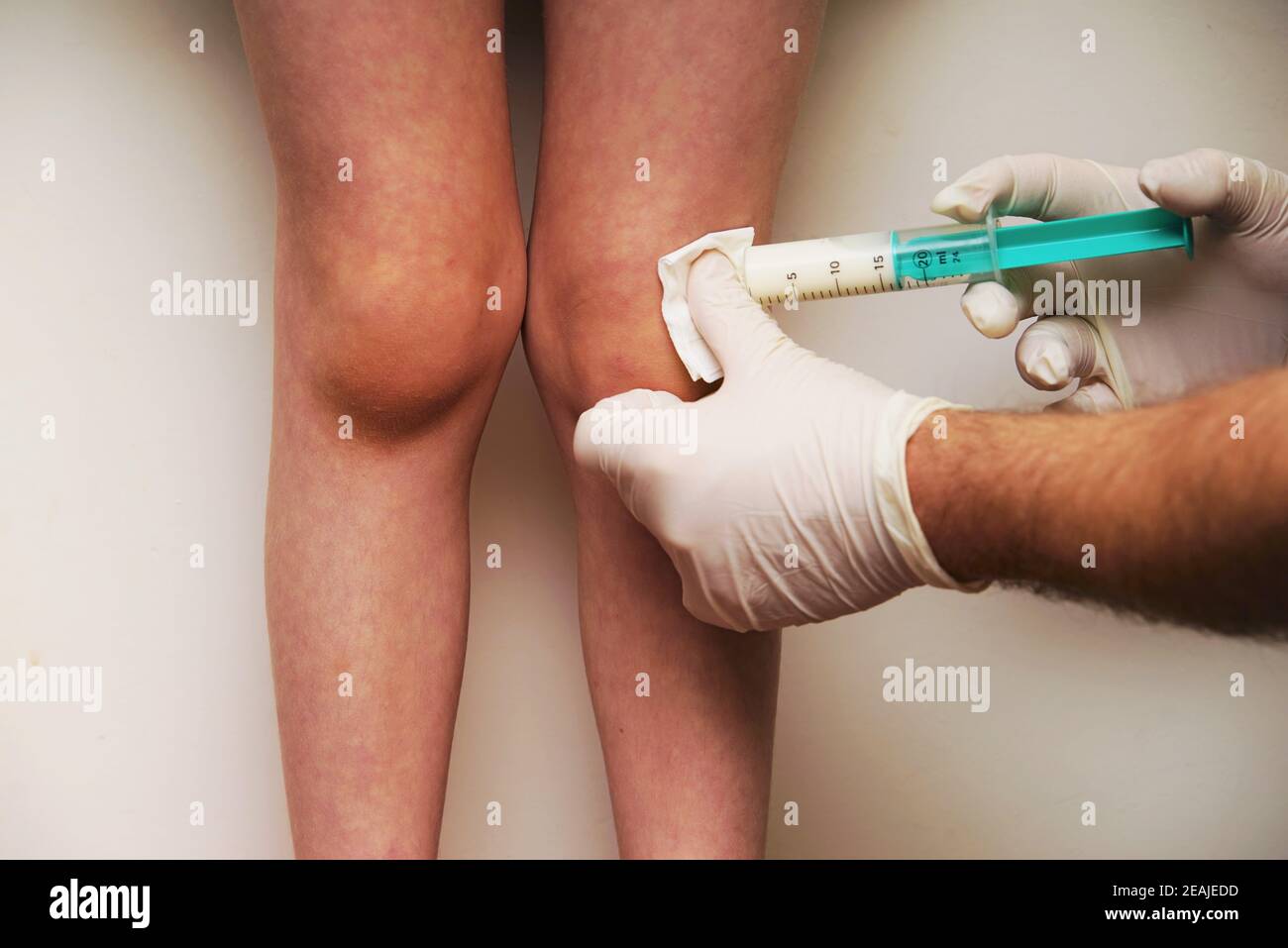 Der Arzt gibt einem Kind eine Injektion in das Bein Stockfoto