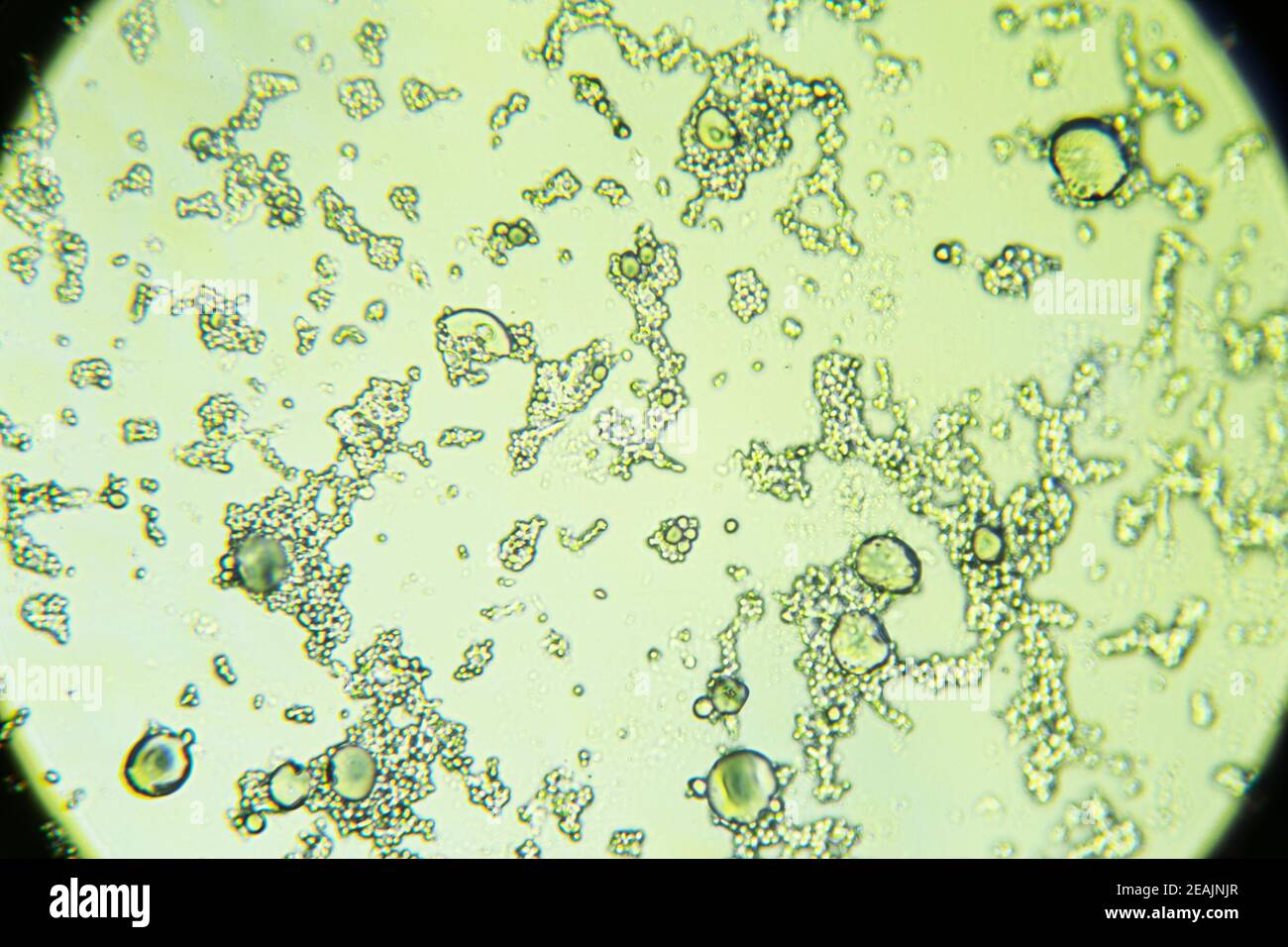 Schimmelsporen unter dem Lichtmikroskop, Orangenhaut-Form, Vergrößerung 400- fach Stockfotografie - Alamy