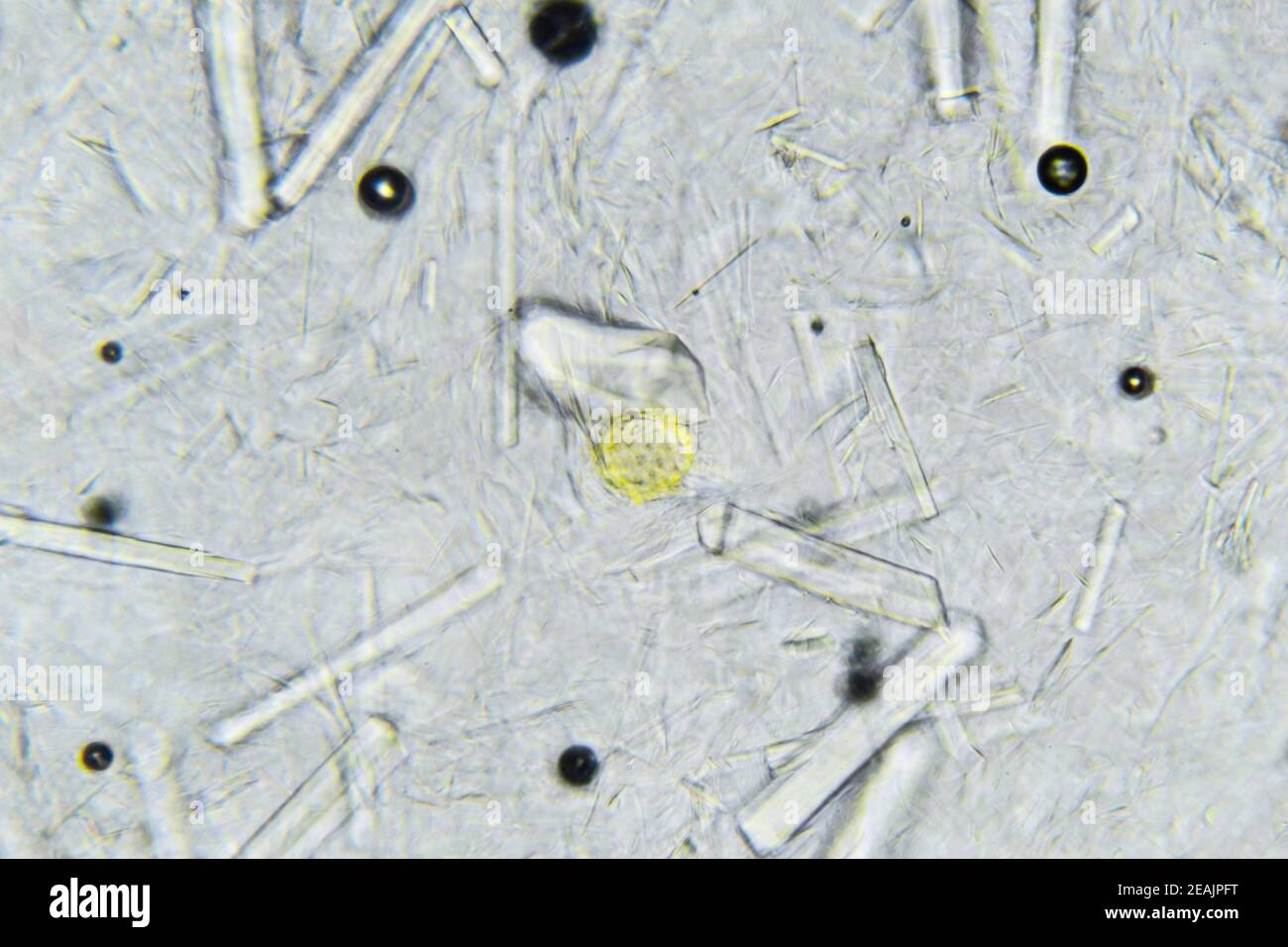Künstlicher Honig mit großen rechteckigen Zuckerkristallen unter dem  Mikroskop. Natürlicher Honig mit Zuckersirup gemischt. Ein vergilbter Pollen  in der Mitte des Stockfotografie - Alamy