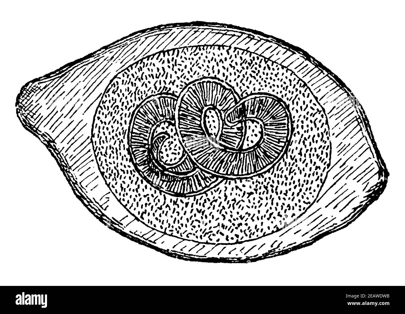 Isolierte Trichinae-Kapsel (Trichinella spiralis). Illustration des 19th. Jahrhunderts. Deutschland. Weißer Hintergrund. Stockfoto