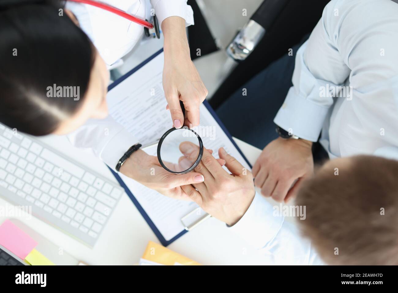 Dermatologe betrachtet Patienten Haut auf Händen mit Lupe Draufsicht Stockfoto