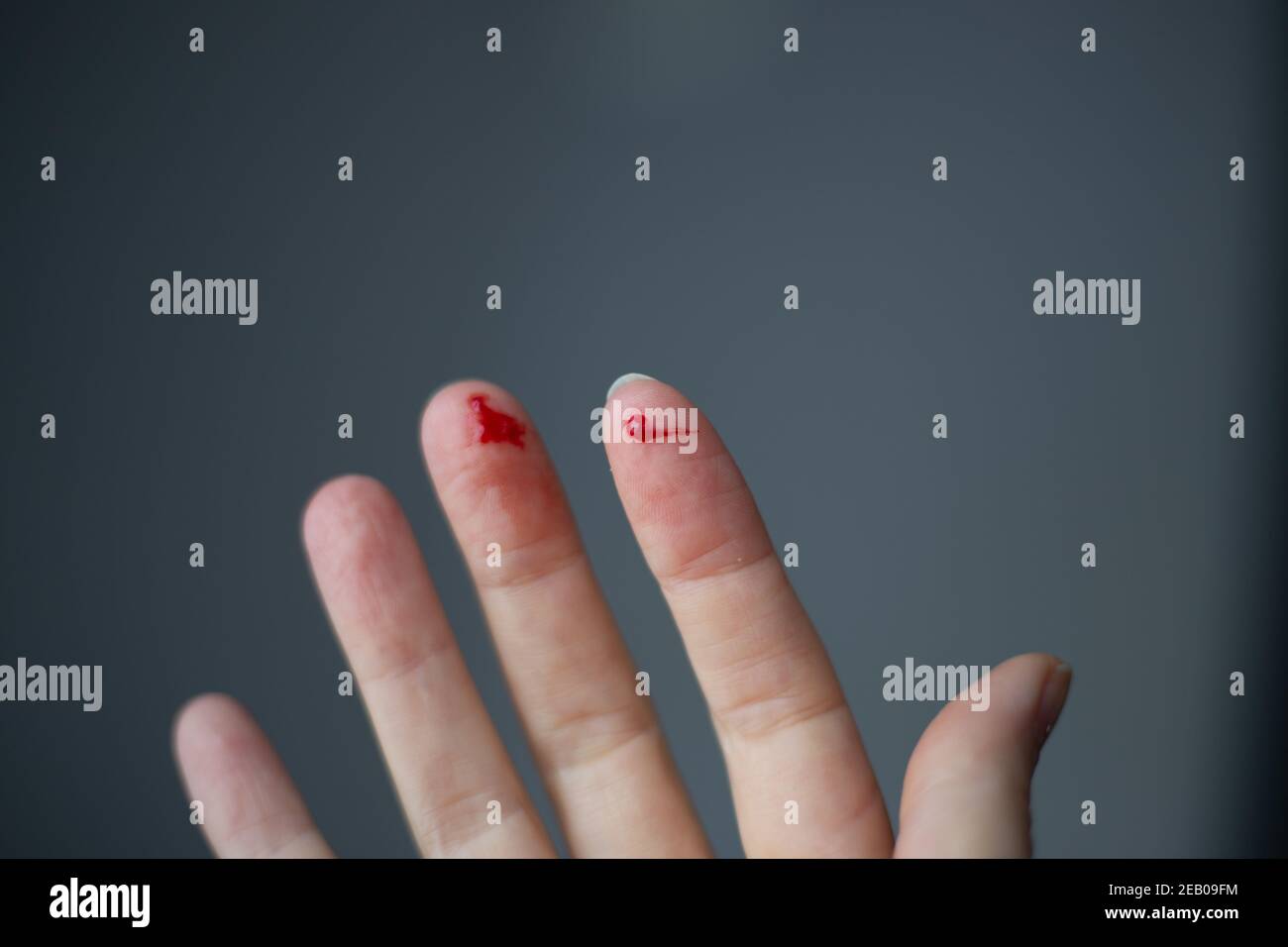 Finger auf der rechten Hand ist geschnitten und blutet mit hellrotem Blut, selektiver Fokus, verschwommener dunkler Hintergrund Stockfoto