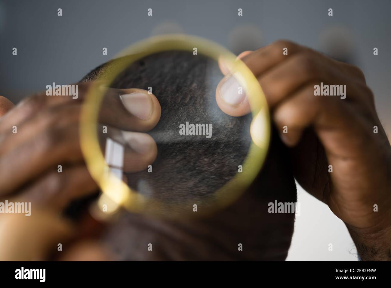 Dermatologe Arzt Prüfung Juckreiz Verloren Afrikanisches Haar Stockfoto