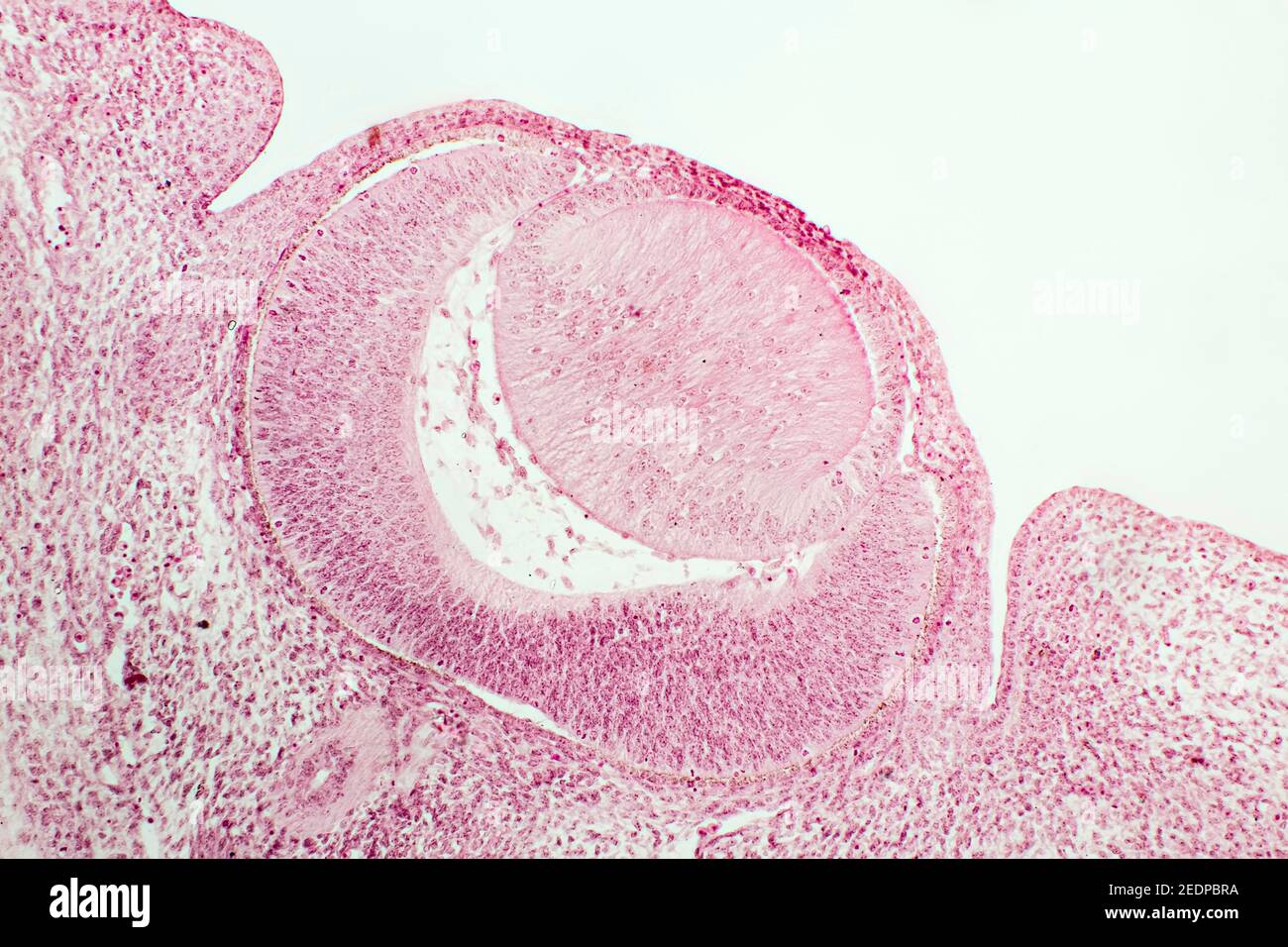 Querschnitt eines Kopfes eines kleinen Säugetiers, Embryo mit ersten Entwicklungsstadien der Augen, x 18 Stockfoto