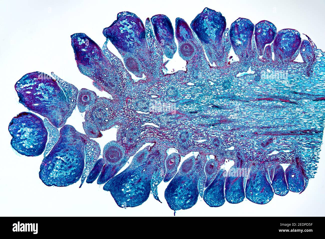 Kiefer (Pinus spec.), Längsschnitt eines jungen weiblichen Kegels einer Kiefer, Mikrotom Abschnitt Stockfoto