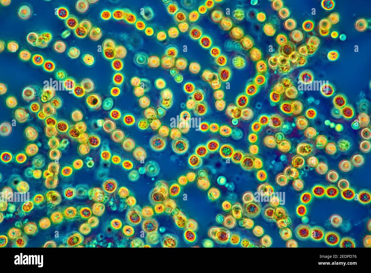 Cyanobakterien, Phase-Kontrast-MRT Stockfoto