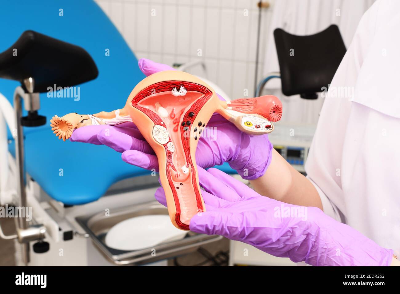 Ein Modell der Gebärmutter einer Frau in den Händen eines Arztes in Gummihandschuhen auf dem Hintergrund eines gynäkologischen Stuhls. Schwangerschaft, Krankheiten der Frauen, Krebs Stockfoto