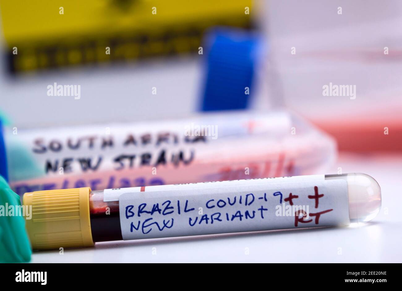 Mehrere Fläschchen von Blutproben positiv für Covid-19-Infektion der neuen Variante in Brasilien, konzeptuelles Bild. Stockfoto