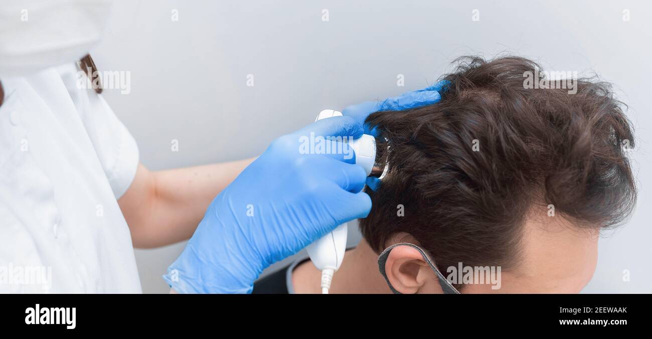 Der Arzt untersucht die Kopfhaut mit einem Trichoskop. Trichologie-Banner. Stockfoto