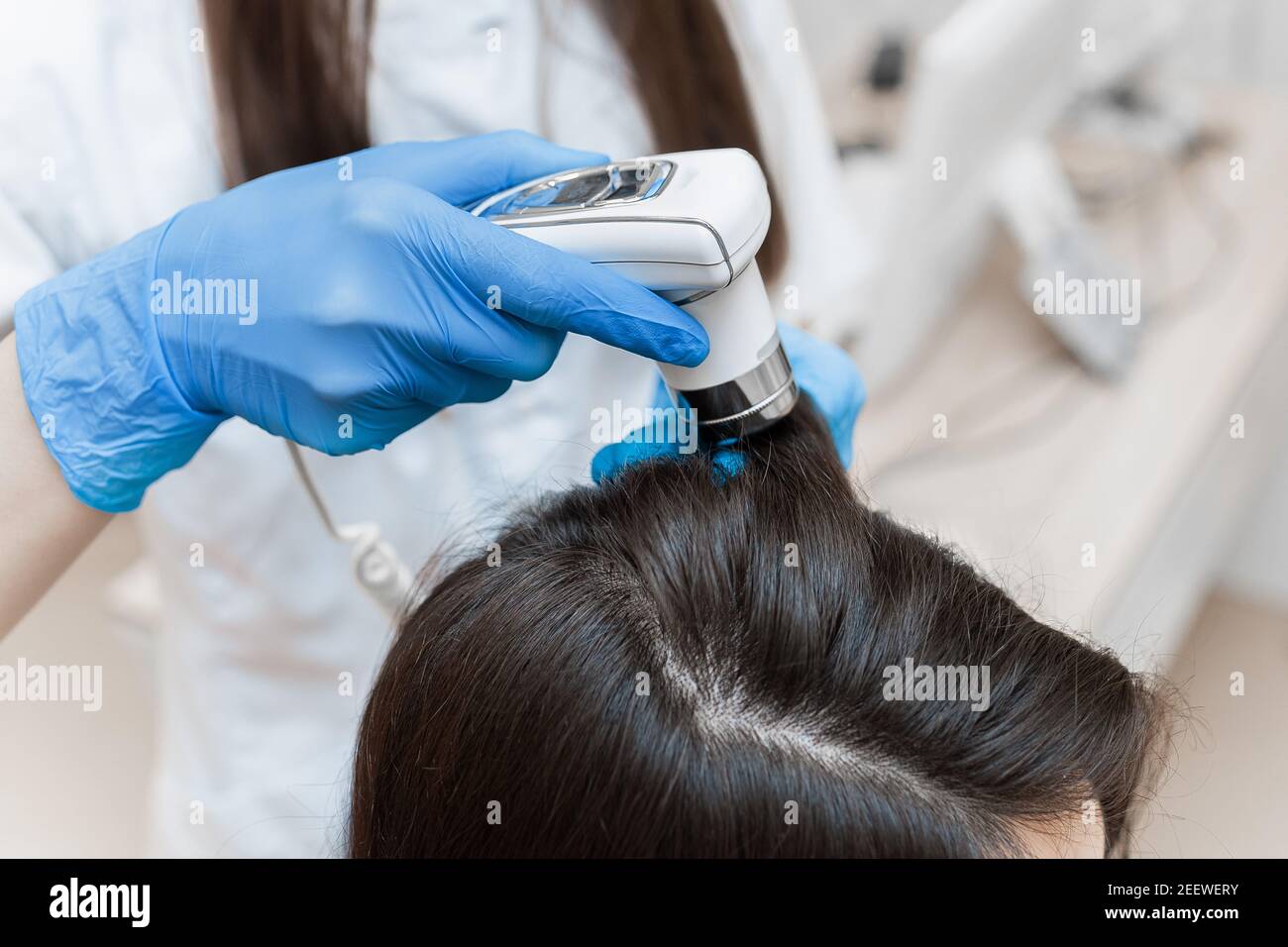 Trichoskopie des Kopfes einer Frau mit einem Trichoskop aus der Nähe. Stockfoto