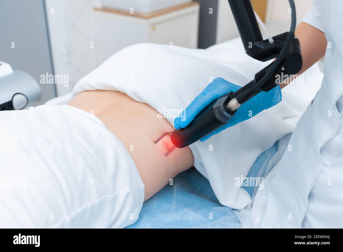 Entfernung von Lasernarben in einer modernen Klinik für Kosmetologie. Stockfoto
