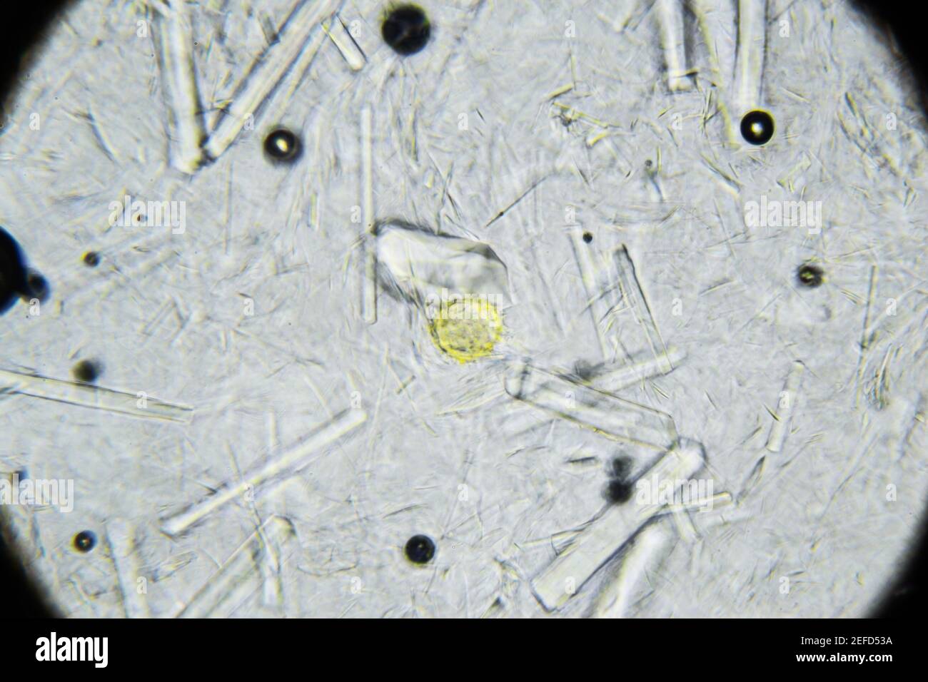 Knstlicher Honig mit groen rechteckigen Zuckerkristallen unter dem  Mikroskop. Natrlicher Honig mit Zuckersirup gemischt. Ein vergilbter  Pollen in der Mitte des Stockfotografie - Alamy