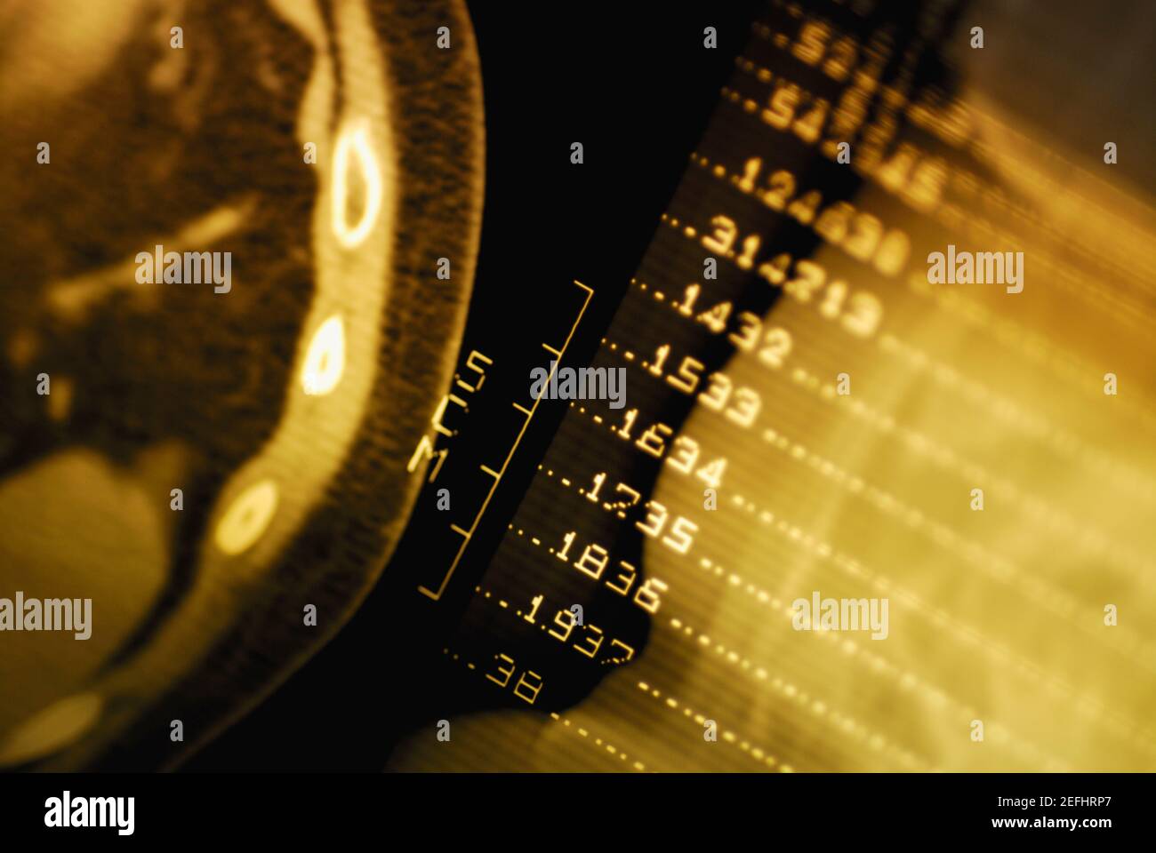 Nahaufnahme eines MRT-Scans Stockfoto