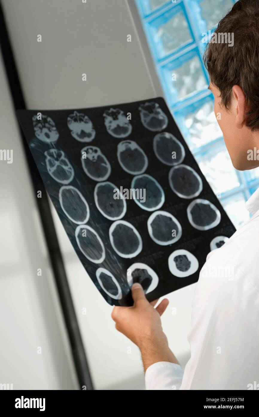 Seitenprofil eines männlichen Arztes, der einen Röntgenbericht untersucht Stockfoto