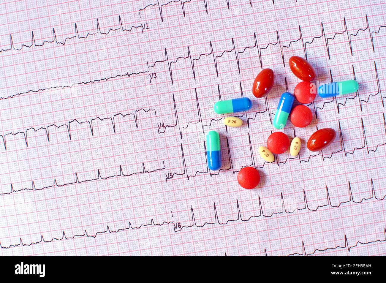 Nahaufnahme von verschiedenen Arten von Pillen, Tabletten und Drogen auf Elektrokardiogramm (EKG oder EKG-Papier) Hintergrund für Gesundheitswesen und medizinische Konzept. Ansicht von oben Stockfoto