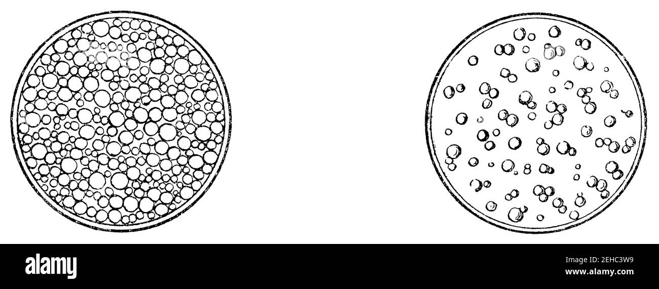 Vollmilch mit dichten Fettzellen (links) und mit Wasser verdünnte Milch (rechts) - die Fettkügelchen sind spärlich verteilt. Illustration des 19th. Jahrhunderts. Deutschland. Weißer Hintergrund. Stockfoto