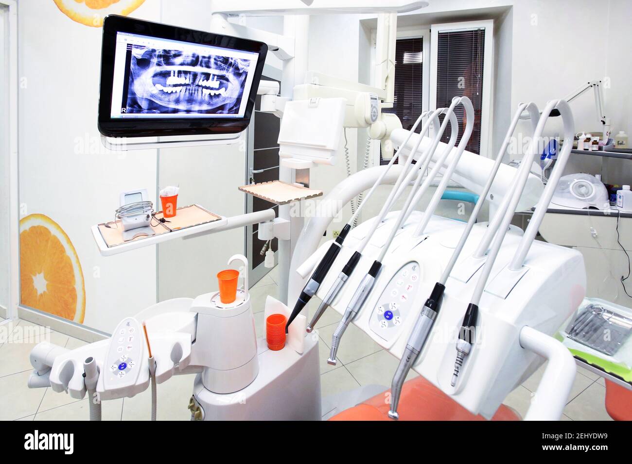 Ein Dental Clinics Tools mit einem Monitor, der das X zeigt Strahl eines Mundes Stockfoto