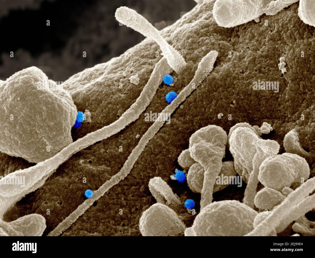 Krim-kongo hämorrhagisches Fieber (cchf)-Virus Stockfoto