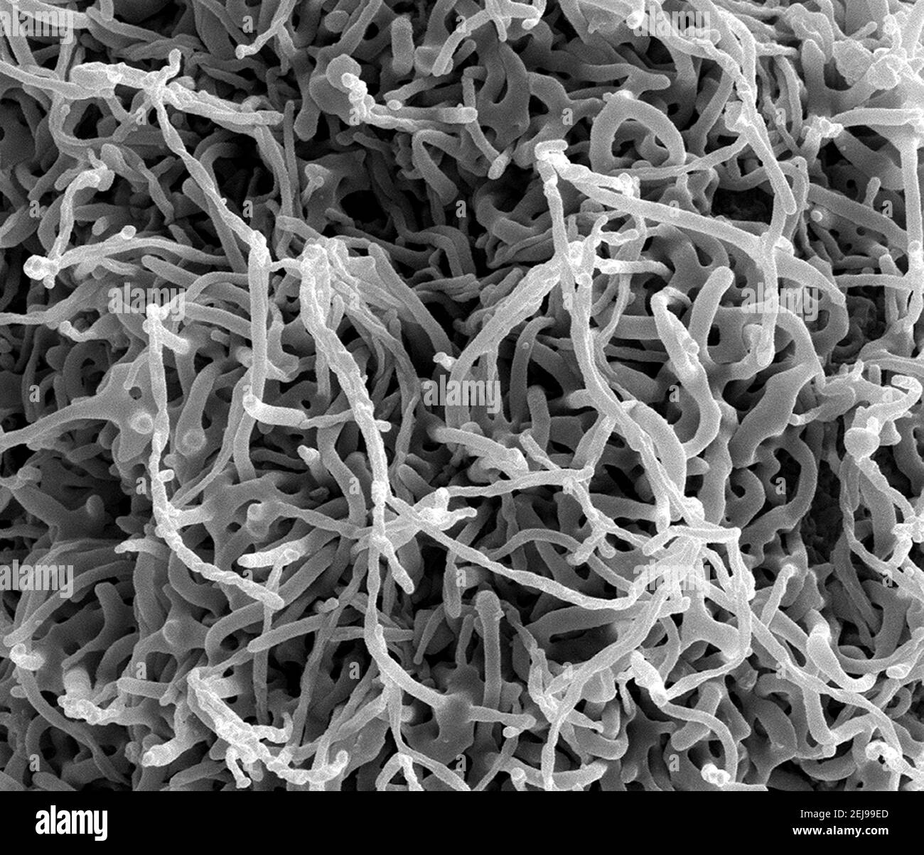 Ebola-infizierte Vero-E6-Zelle Stockfoto