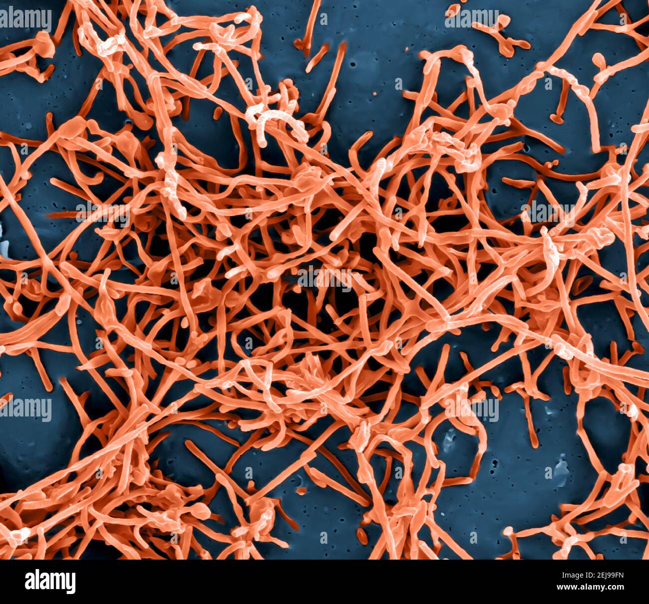 Ebola-Virus-Partikel Stockfoto