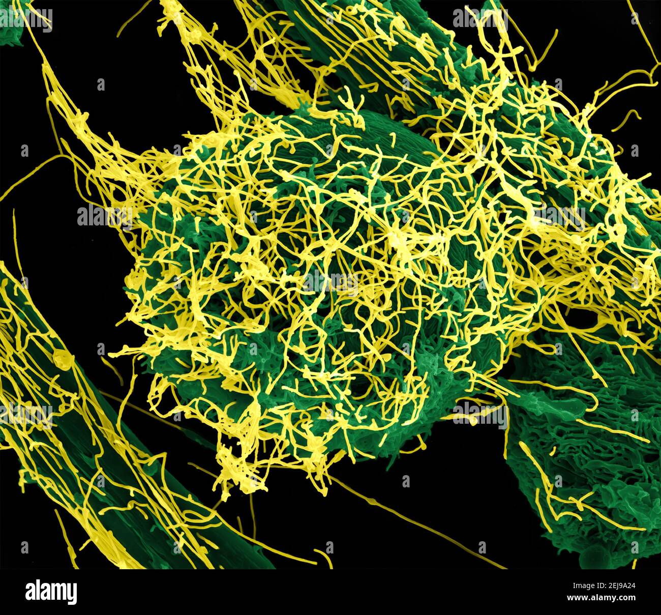 Ebola-Virus-Partikel Stockfoto