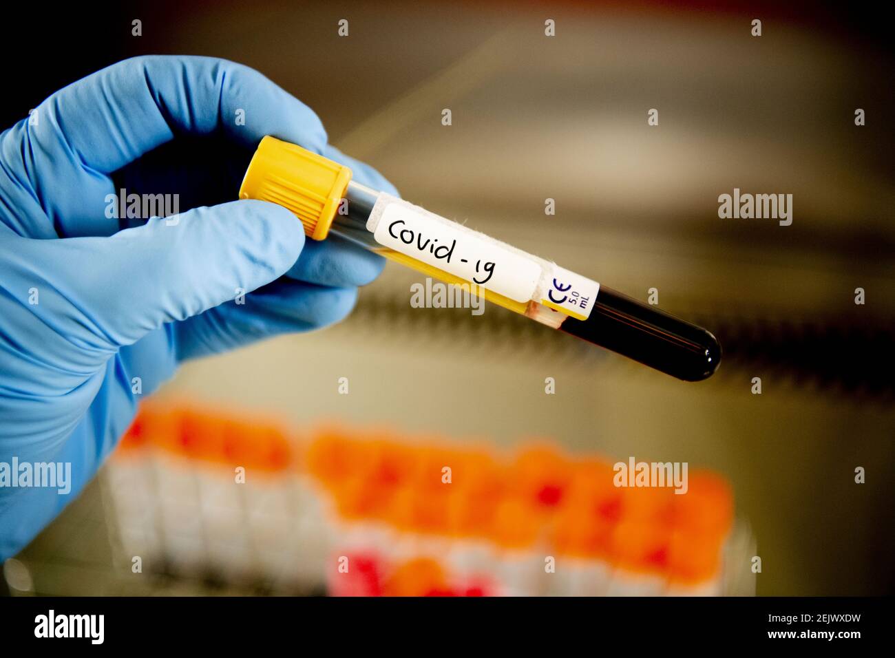 Ein Labortechniker Der Ein Testrohrchen Halt Das Blutproben Eines Patienten Enthalt Der Im Amphia Krankenhaus Positiv Mit Dem Covid 19 Coronavirus Getestet Wurde Das Amphia Hospital Fuhrt Derzeit Zwischen 400 500 Tests Pro Tag Fur