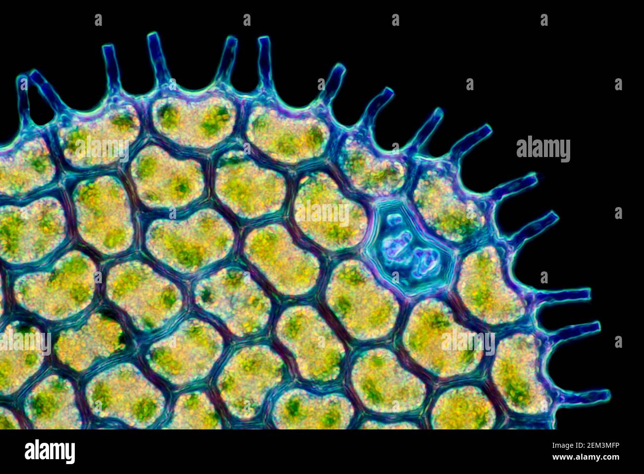 Grünalge (Pediastrum spec.), koloniebildende Grünalgen, Dunkelfeld mikroskopisches Bild, Vergrößerung x180 bezogen auf 35 mm Stockfoto