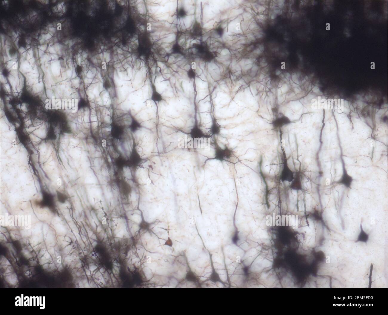 Hirnschnitt der Maus mit dem Golgi-Fleck gefärbt, eine 19th-Jahrhundert-Technik, die bis vor kurzem weit verbreitet war - und gelegentlich noch ist. Stockfoto