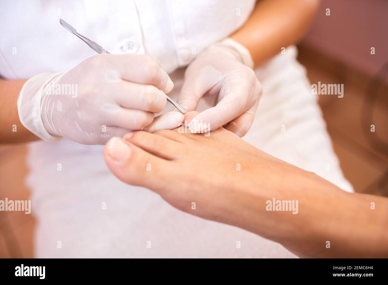 Schieben Sie die Nagelhaut auf die Zehen mit Schuppenstäube zurück Stockfoto