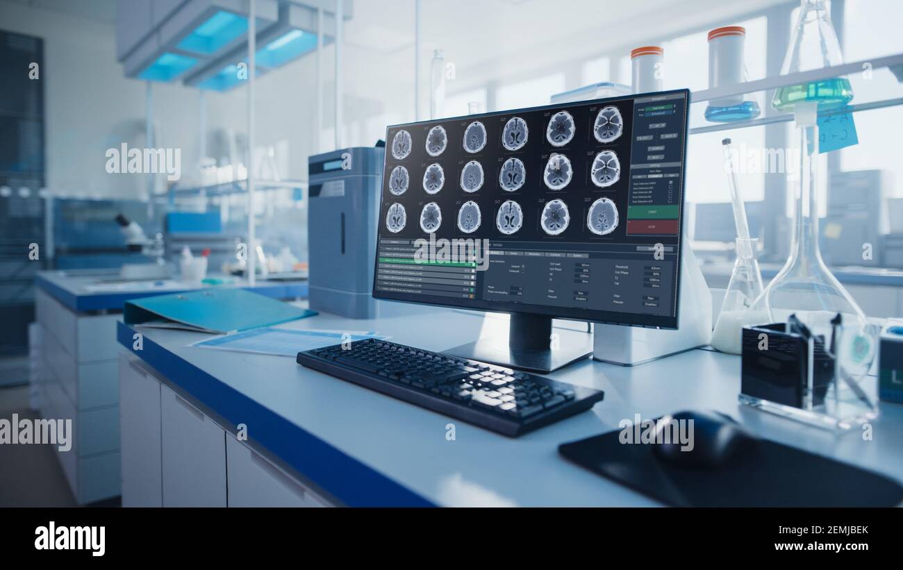 Modernes medizinisches Forschungslabor mit Computer, der MRT-Gehirnscans zeigt. Glaswaren mit Biochemikalien auf dem Schreibtisch. Wissenschaftliche Labortechnologie Stockfoto