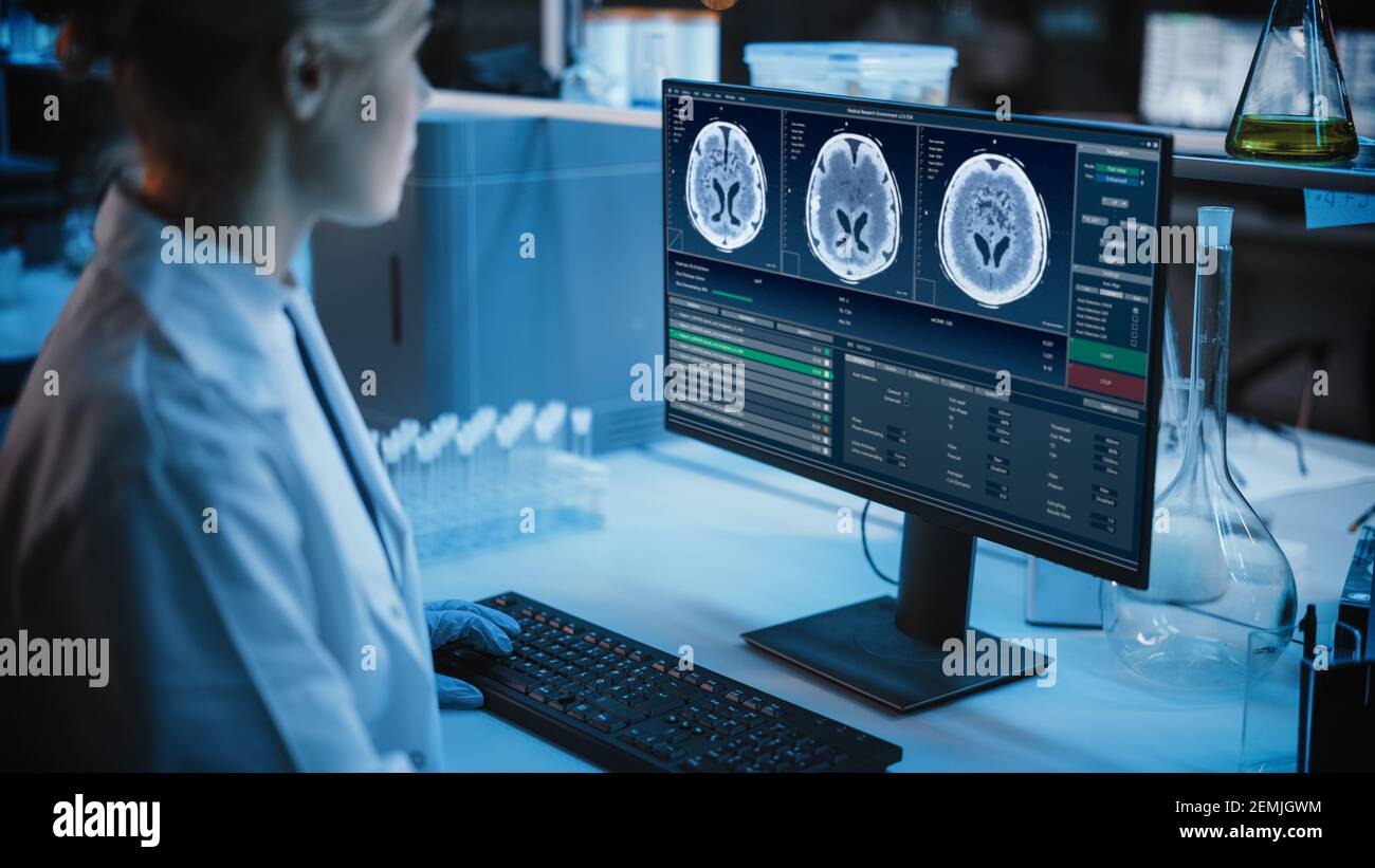 Medizinisches Forschungslabor: Portrait einer Wissenschaftlerin, die am Computer arbeitet und MRT-Gehirnscans zeigt. Fortgeschrittenes wissenschaftliches Labor für Medizin, Krebs Stockfoto